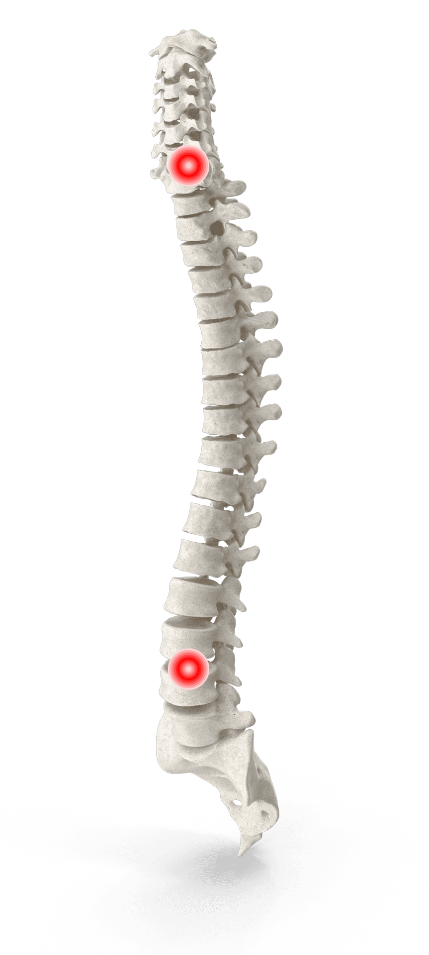 Spine Image for Atlanta Chiropractics